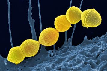 image of strep A bacteria